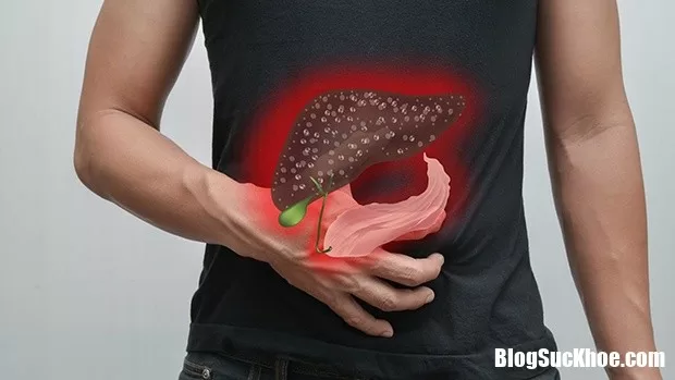 Tìm hiểu về viêm gan, viêm túi mật để kiểm soát bệnh tốt hơn