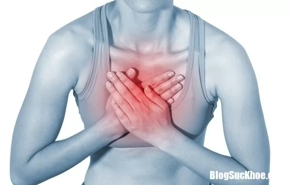 Cẩn thận với những dấu hiệu báo trước cơn nhồi máu cơ tim