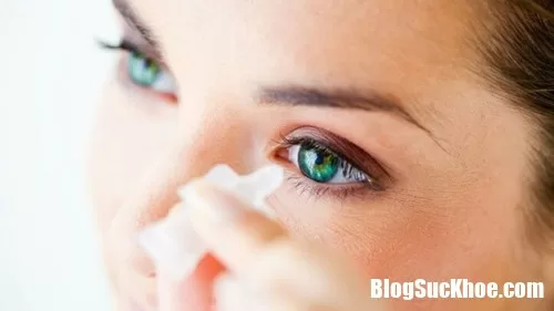 Thị lực giảm do dùng thuốc nhỏ mắt sai cách