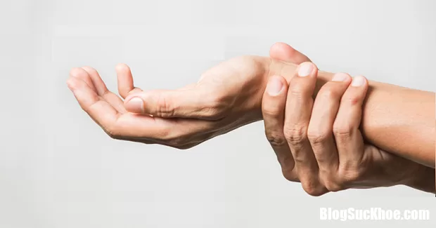 Bệnh thấp khớp và những biến chứng nguy hiểm