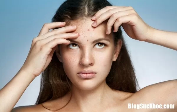Chế độ ăn uống cho người lớn bị thủy đậu