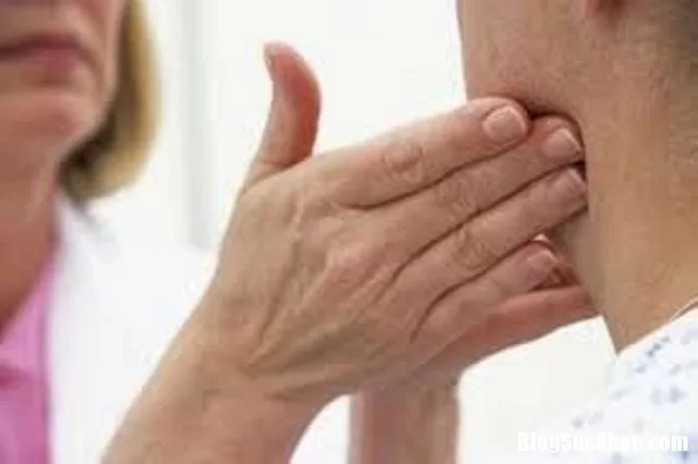 Cổ nổi hạch là báo hiệu bệnh gì ?