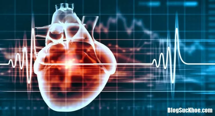 Những cách giảm nguy cơ đột quỵ hiệu quả nhất