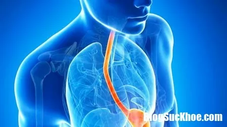 Những dấu hiệu cảnh báo trào ngược dạ dày nguy hiểm chớ nên thờ ơ