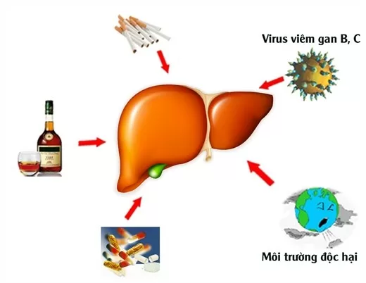 Phát hiện sớm bệnh ung thư gan thông qua những dấu hiệu trên cơ thể