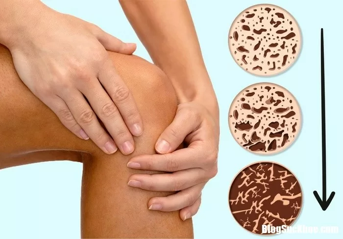Các dấu hiệu cảnh báo tiền mãn kinh mà chị em không hề hay biết