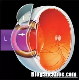 Tìm hiểu về căn bệnh mù màu thường gặp