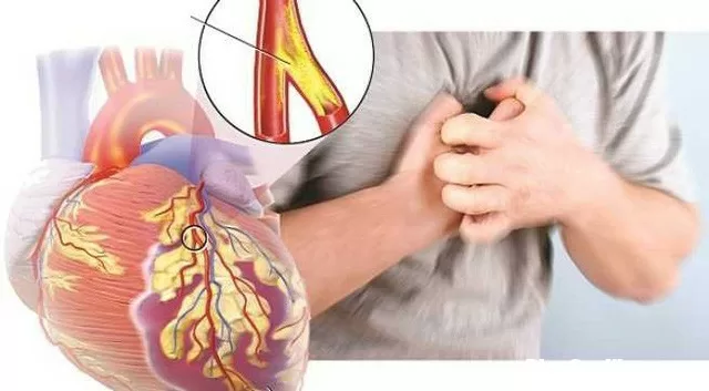 Những thói quen giúp người trẻ tránh xa bệnh tim mạch
