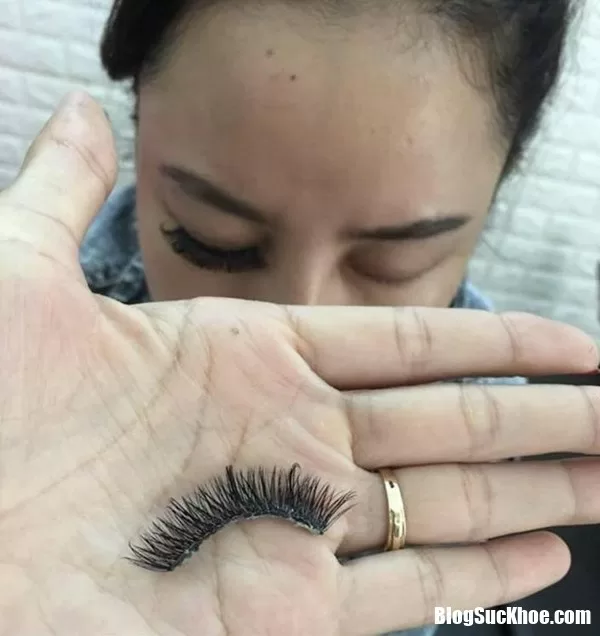 Nổi da gà khi nhìn thấy tác hại của việc nối mi giả