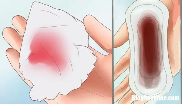 Dấu hiệu kinh nguyệt bất thường phản ánh tình trạng sức khỏe sinh sản