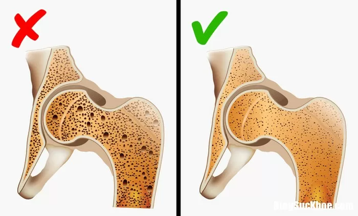 Những căn bệnh nguyên nhân chính là di truyền từ mẹ