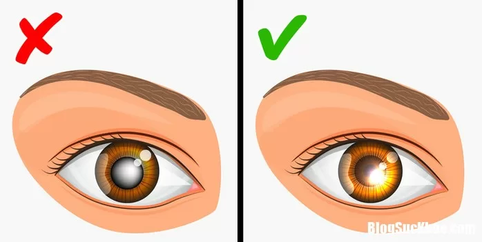 Những căn bệnh nguyên nhân chính là di truyền từ mẹ
