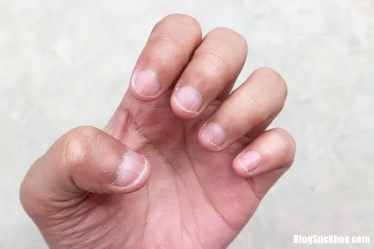 Những thói quen tưởng vô hại nhưng ảnh hưởng lớn đến sức khỏe con người