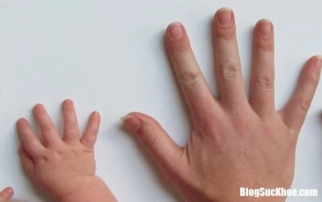 Tình trạng móng tay thay đổi là dấu hệu báo bệnh nguy hiểm