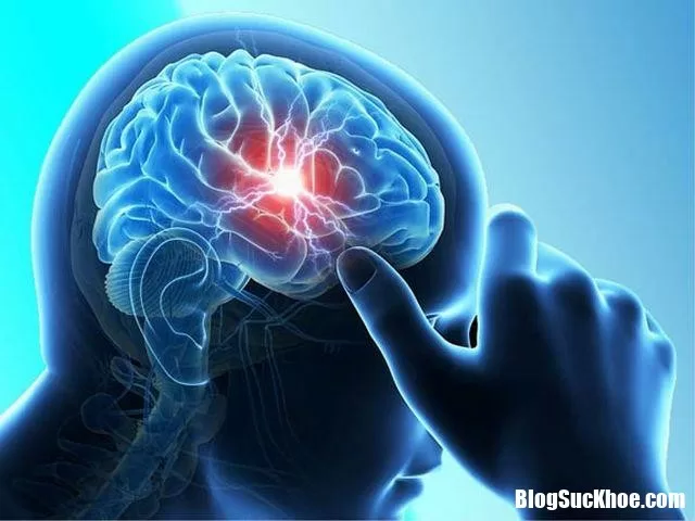 Hiện tượng xuất huyết não xảy ra ở giới trẻ ngày càng nhiều