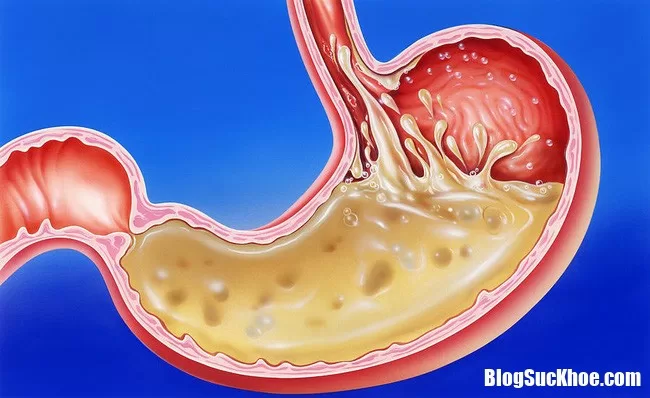 Tuyến nước bọt hoạt động quá tốt lại là dấu hiệu báo bệnh nội tạng