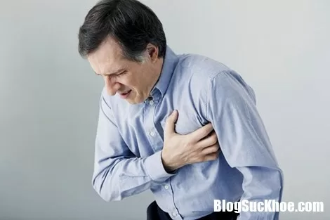 Những điều ít biết về căn bệnh tai biến mạch máu não