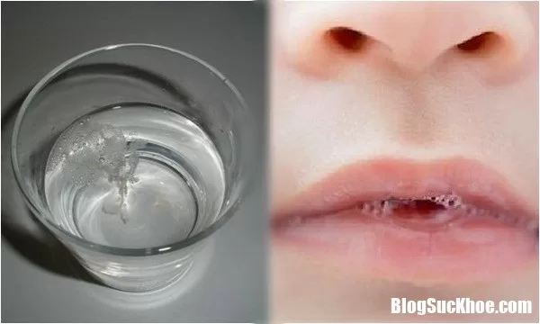 Nhận biết bệnh phụ khoa qua dấu hiệu lạ của nước bọt