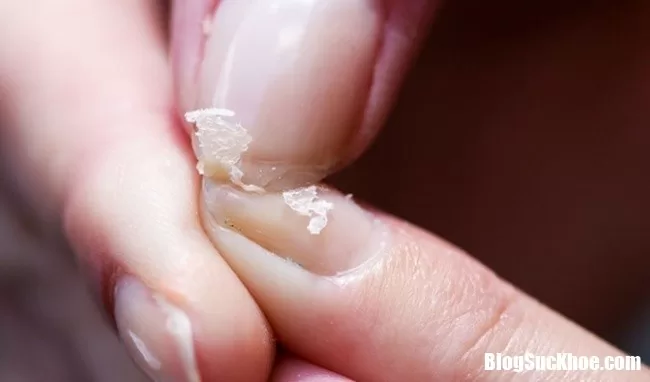 Cơ thể gặp nhiều rắc rối nếu tiêu thụ quá nhiều muối