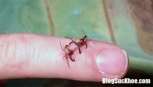 Các phương pháp chữa bệnh được tin dùng từ thời cổ đại