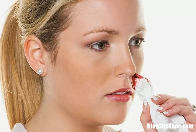 Những dấu hiệu lạ không gây đau nhưng tiềm ẩn nguy cơ chết "bất đắc kỳ tử"