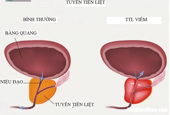 Nguyên nhân khiến tinh trùng bị biến dạng, ảnh hưởng đến sinh sản