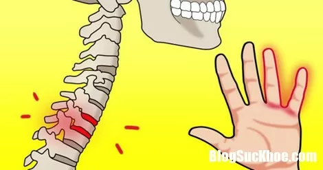 10 căn bệnh chết người có dấu hiệu ban đầu là tê tay