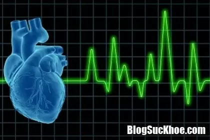 Tim đập nhanh là dấu hiệu bệnh gì? Làm gì để ngăn chặn?