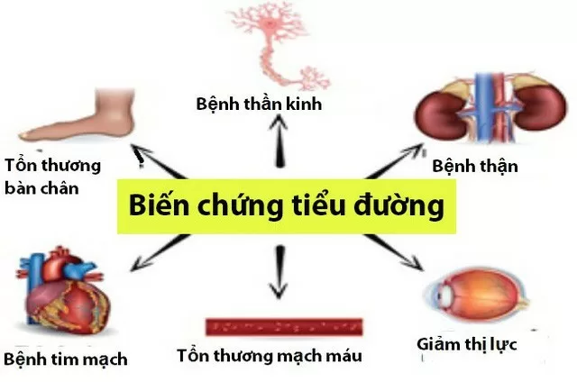 Khả năng hạ đường huyết vô cùng vượt trội của cây thìa canh lá to
