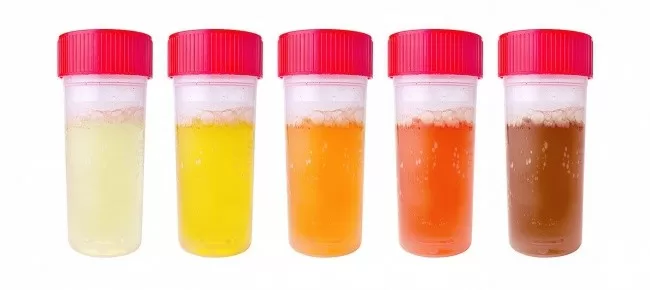 Những dấu hiệu chứng tỏ bạn mắc bệnh thận mà bạn không hề hay biết