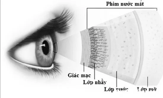 Hãy đề phòng khô mắt do thuốc