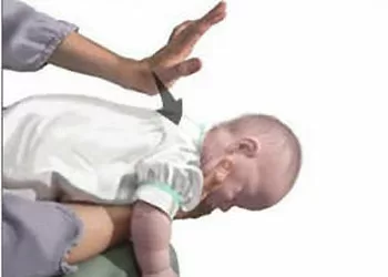 Cách xử lý khi trẻ bị hóc sặc dị vật